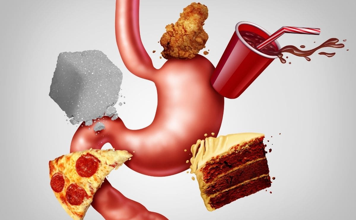 La acidez estomacal ocasional puede estar causado por la alimentación